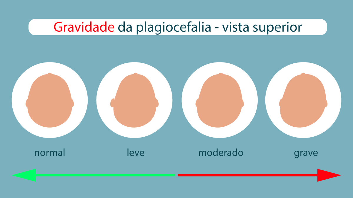 Anello FILODELLAVITA 7 Fili Oro Bianco 9 Kt E Diamante Solitario - Foto 2